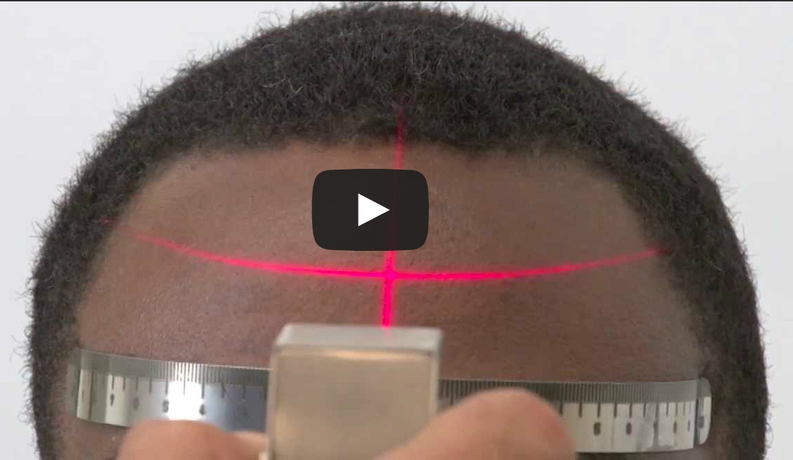 Path D Laser Assist Hairline Design Device - New Product